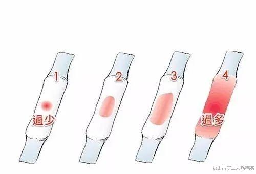 卵巢|月经量少，是宫寒？早衰？其实原因是……