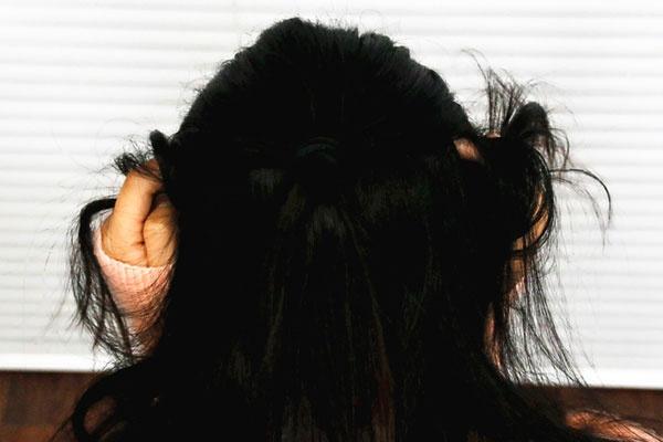 |雌性激素“匮乏”的女性，可能有这3处共同点，希望你能避免