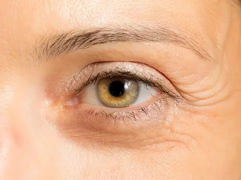 衰老|皮防科普丨抗皱,你知道它的类型吗?