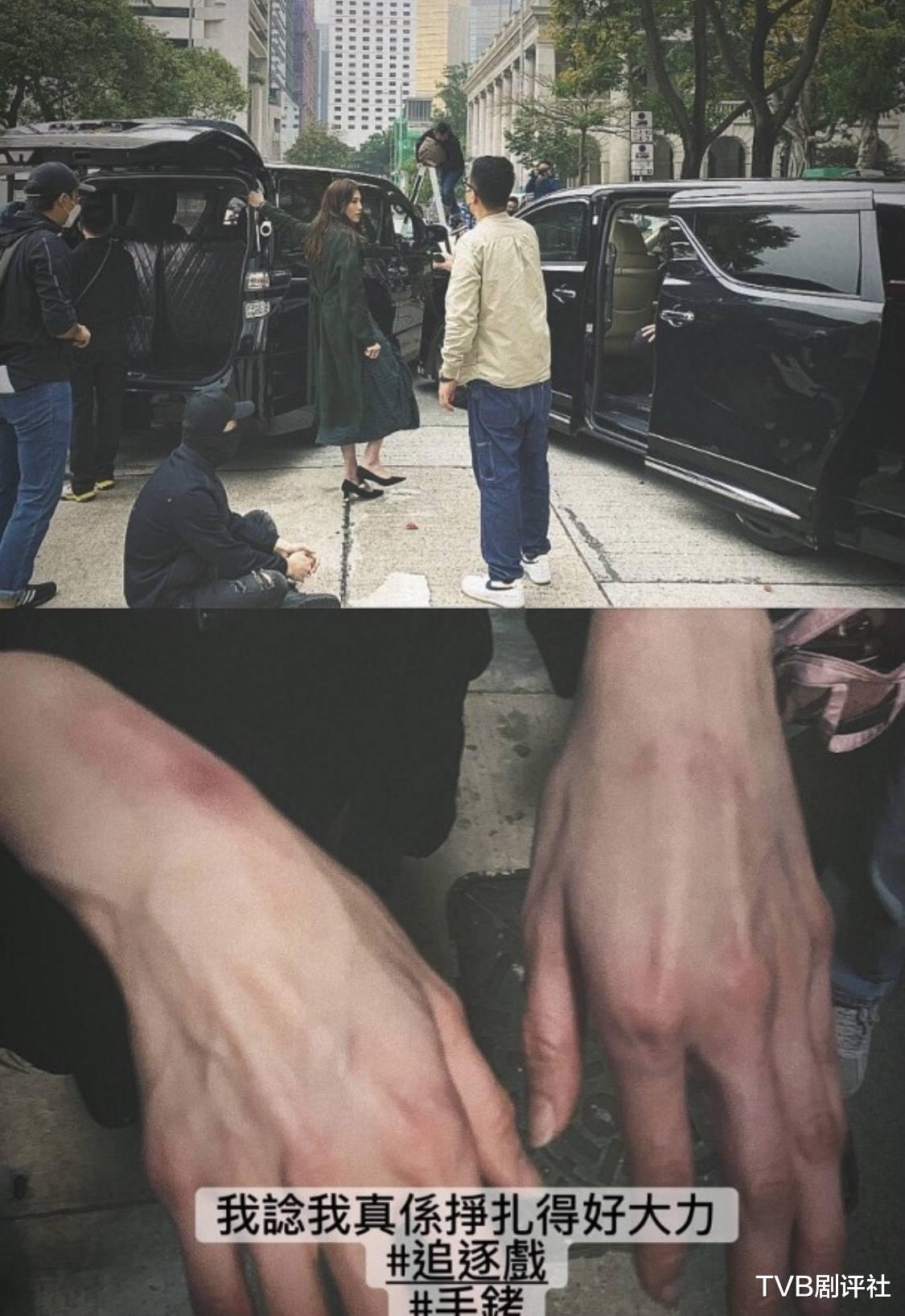 周秀娜|周秀娜越打越有感觉，双手淤青仍无惧，金牌监制加黄宗泽值得期待