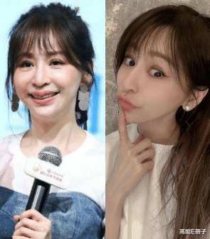 整形|台湾艺人整形记:削骨换脸小场面,嫁给医师保修终身