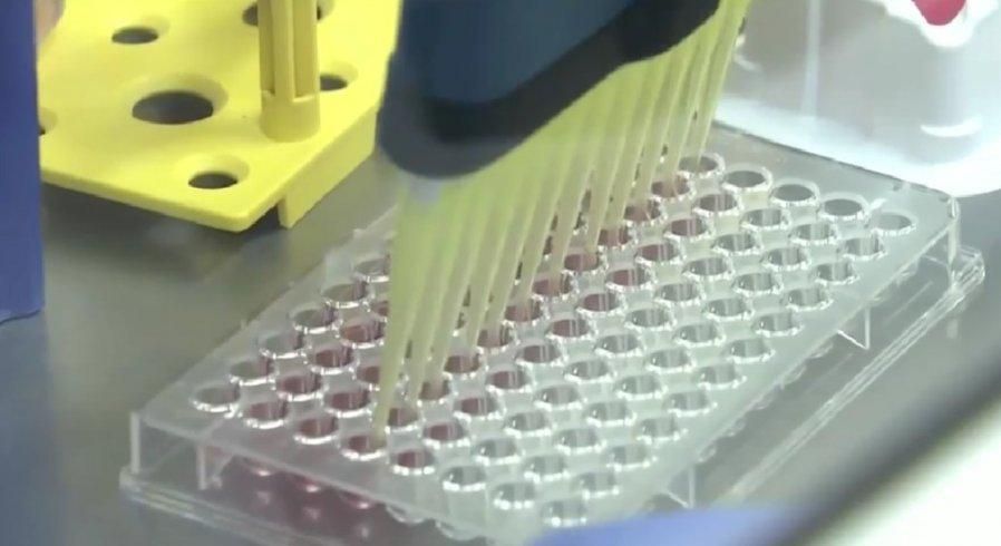 日本科学家用皮肤细胞 成功培育能长出头发毛囊