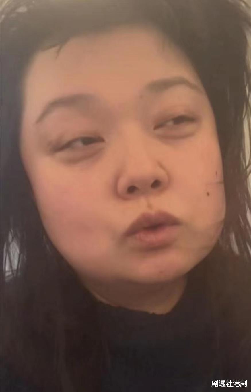 陈嘉佳|憔悴！TVB前搞笑女星晒病恹恹近况，曝三天没洗头没洗澡连狗都嫌臭