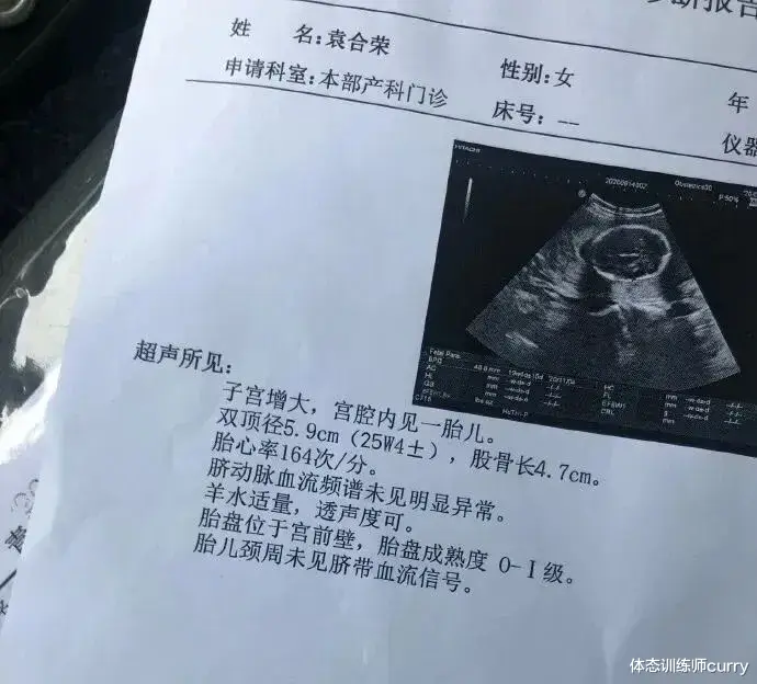 怀孕|全身肌肉的白衣天使,因模仿“不知火舞”走红,孕期仍坚持健身?