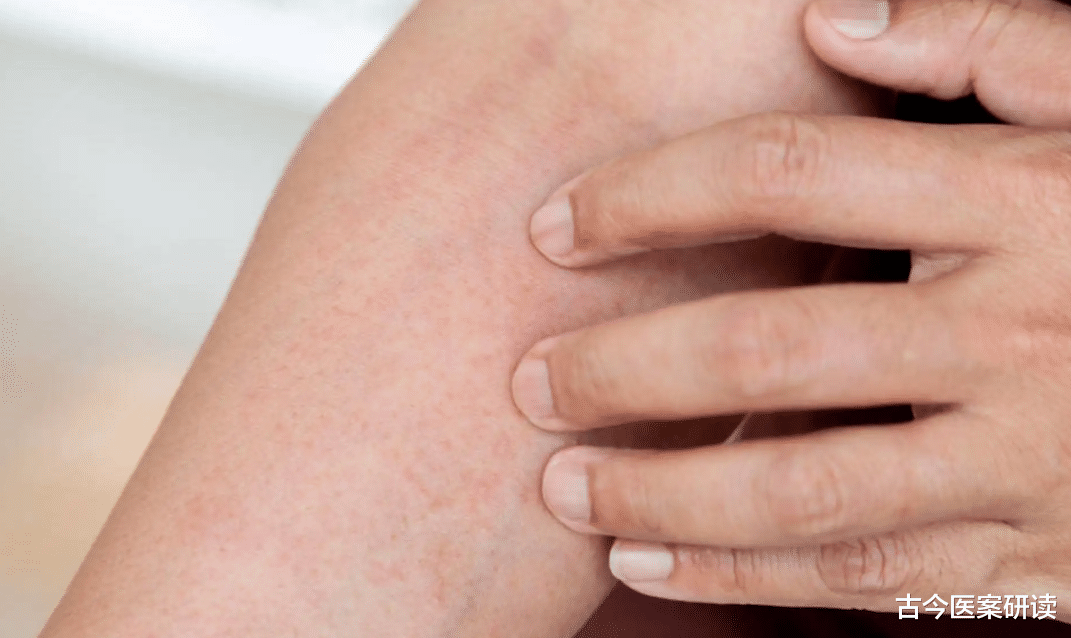 血糖|多名专家联合声明：身体2处“发痒”，或是血糖“已超标”，需警惕