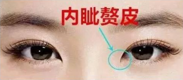 这三个特征,只有黄种人身上才有,你知道吗