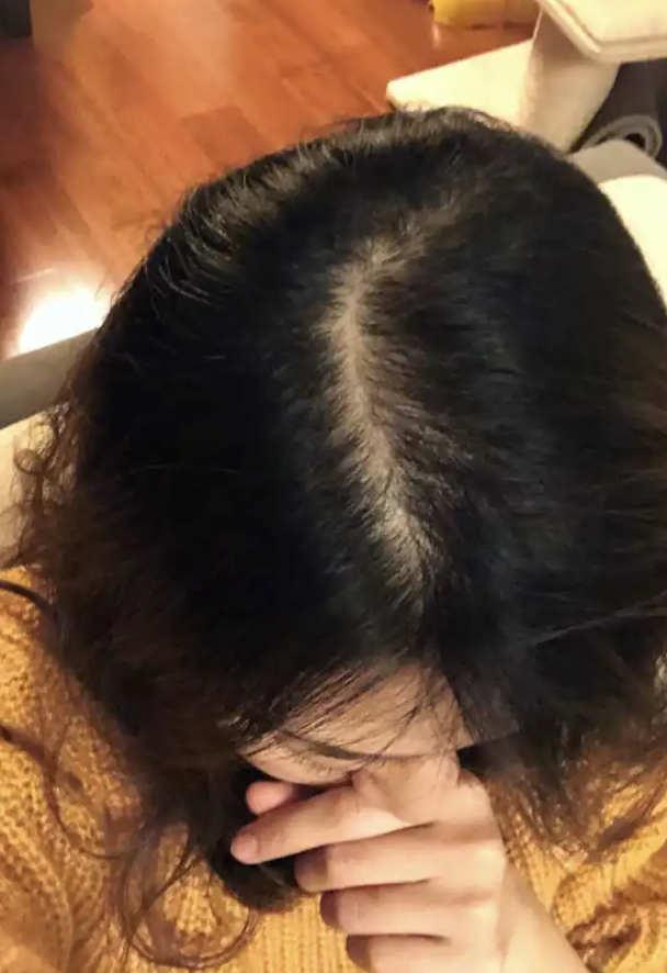洗发水 建议大家：这3种“洗发水”慎重购买，虽卖得很火却存在不少隐患