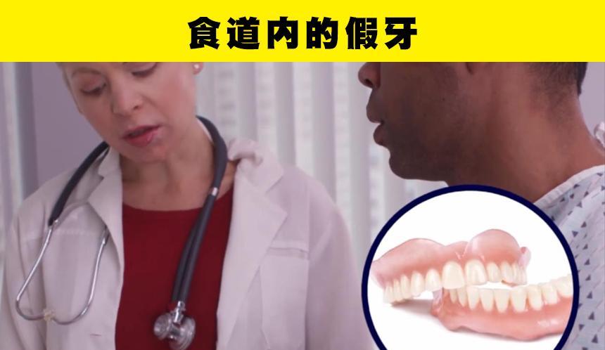 在人类的身体里,被找到的7个令人意外的事物
