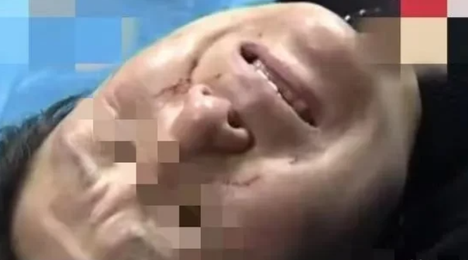 张女士在试穿裤子后因没有买遭嘲讽被店员等人围殴,该店却是另外一种说辞