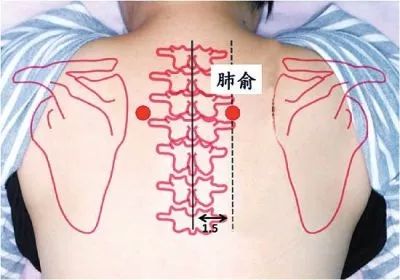 白癜风|天凉请加衣，白癜风患者这5大部位需要特别保暖！