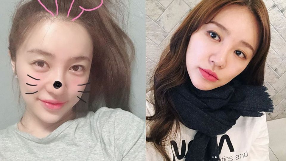 补水 僵脸丰唇尹恩惠急甩20斤消失5年复出被群嘲,她换了一只唇膏而已