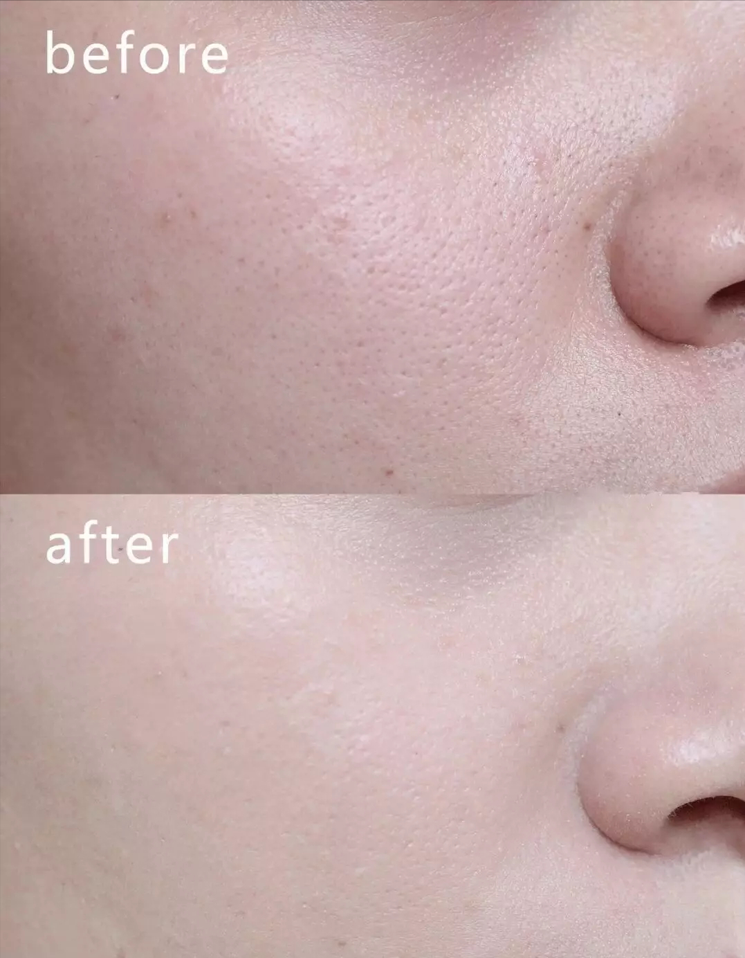 粉底液 有一种“尴尬”叫女星卡粉,高清镜头下妆容斑驳,细纹卡粉显老10岁