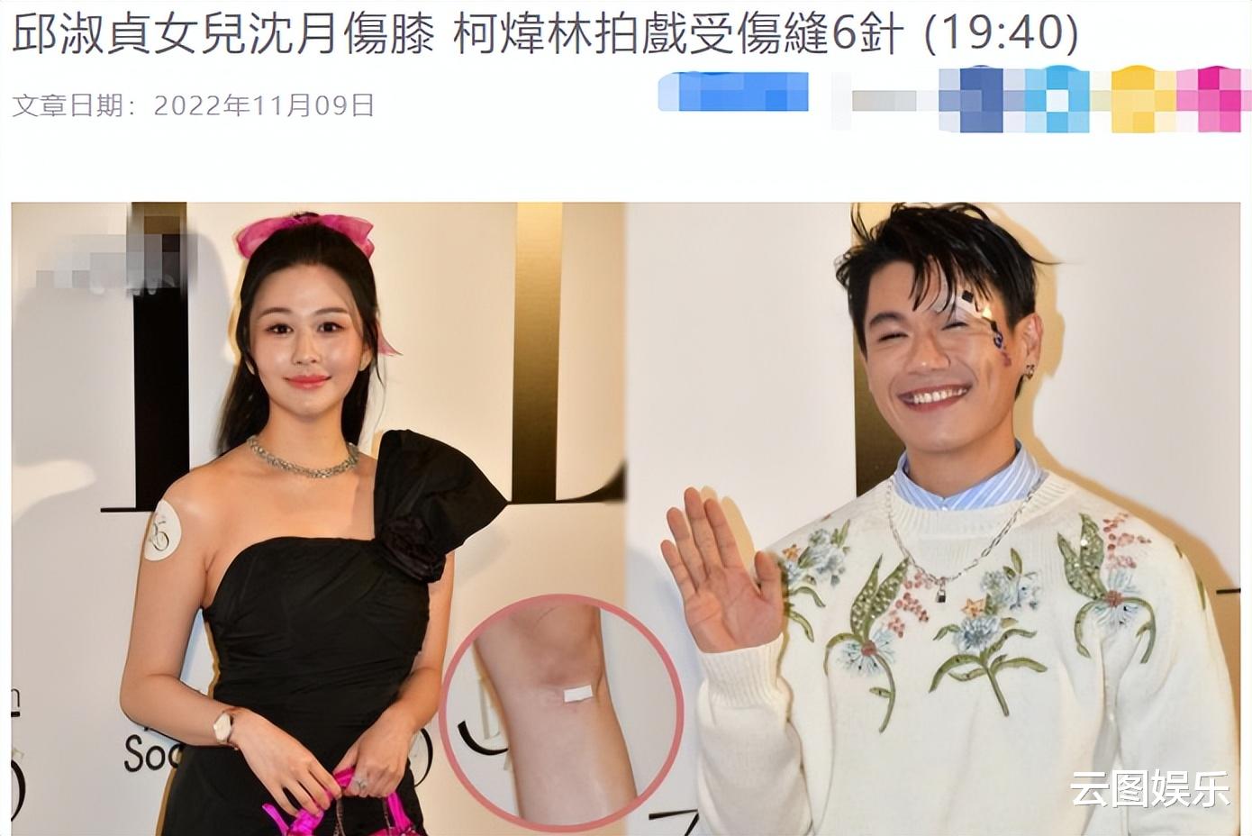 邱淑贞|邱淑贞女儿参加派对,穿短裙膝盖受伤,30岁男星脸上缝6针现身