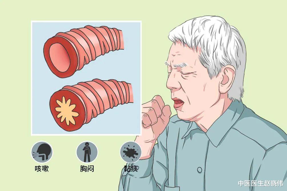 慢性支气管炎|天气逐渐变冷,慢性支气管炎容易复发怎么办?