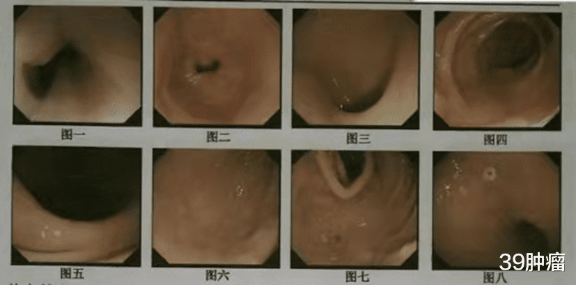 长寿|体重和寿命有关?研究发现:微胖的老人或许更长寿,你达标了吗