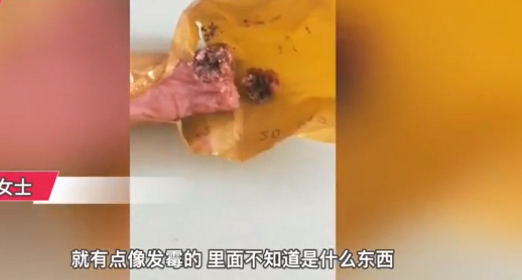 吃火腿肠发现黑霉斑,女子找到商家反映,商家:不属于质量问题