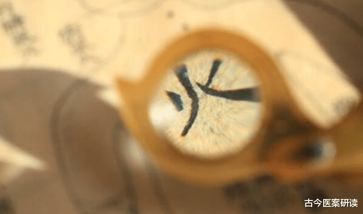 牙齿|中医理论：牙疼不要仅治牙，“两点”不注意，牙齿早晚要掉光