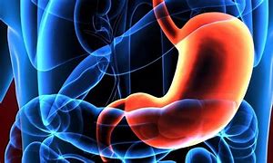 调料|得了胃溃疡很严重吗?有什么治疗手段