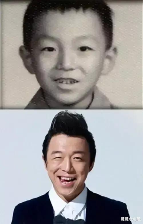 |万万没有想到,图一这个满嘴烂牙的小男孩,在未来竟然可以成为公认的大帅哥