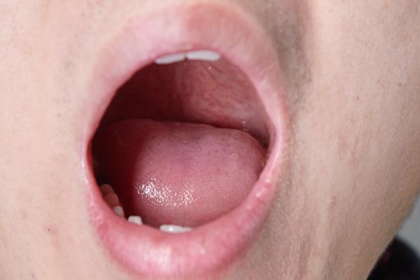 痛风|起床后，口干、口苦、口臭，往往是三个原因导致的，须提高警惕