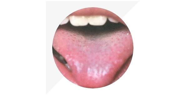 身体的秘密|中医要看舌头的原因，原来是舌头隐藏着身体的秘密，还会发生变化