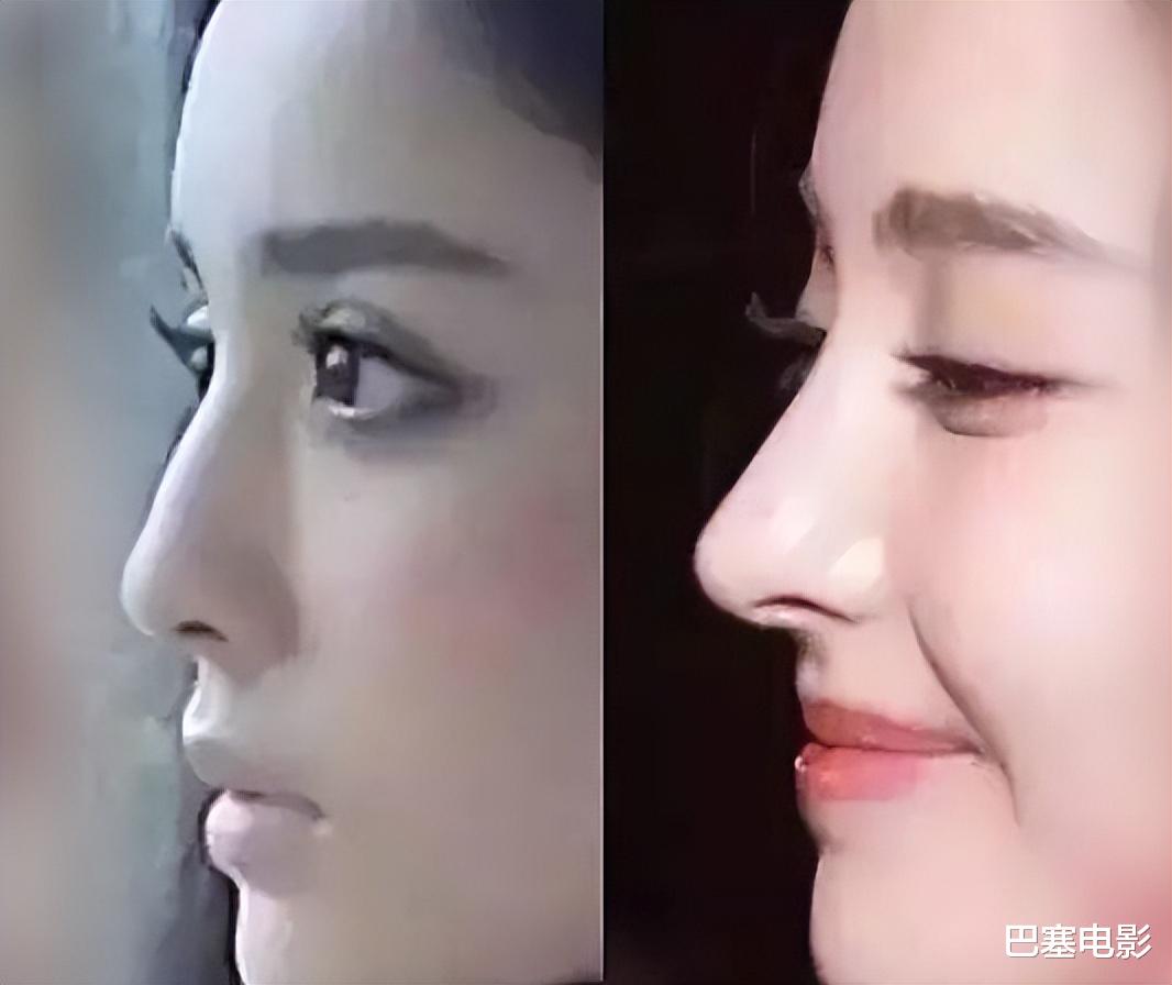 牛莉|好好的美女非去弄鼻子,林心如鼻子像被夹住,牛莉一个鼻孔两个大