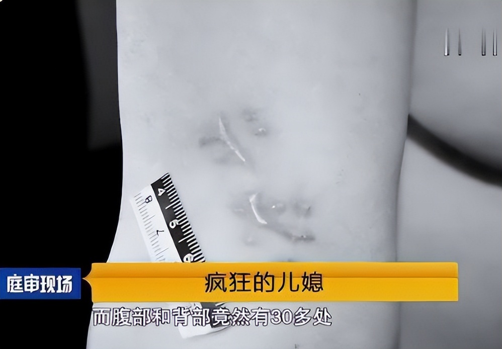 2013年北京儿媳常年被殴打,捅婆婆38刀后电告丈夫:我把你妈扎了