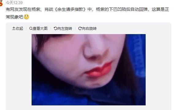 景甜|《余生》正在热播,杨紫下巴凹陷回弹,网友:能换个好的医生吗?