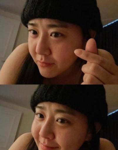 文瑾莹|国民妹妹文根英消失多年，因患病险截肢，4次手术后终康复