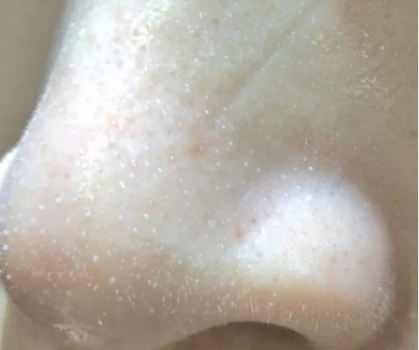 黑头 全网公认“恶心”国货首次曝光！蜂花香皂高级，澳芙泥膜黑头克星