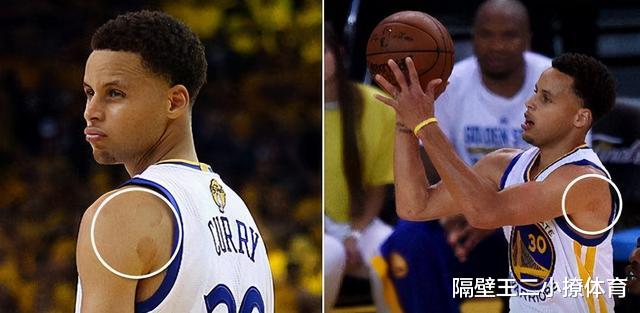 |NBA球星对拔火罐多么痴迷？库里情有独钟，罗斯则近乎痴狂