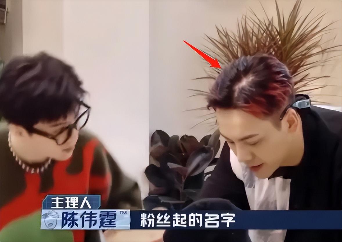 沙溢|看似帅气,实则脱发严重!沙溢、彭于晏、白敬亭......心酸又好笑