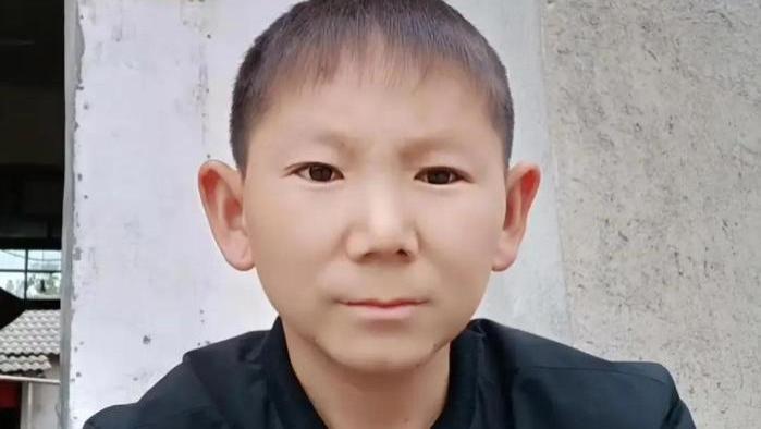 湖北小伙，年幼被石子砸中获“不老容颜”34岁无法娶妻：我还小