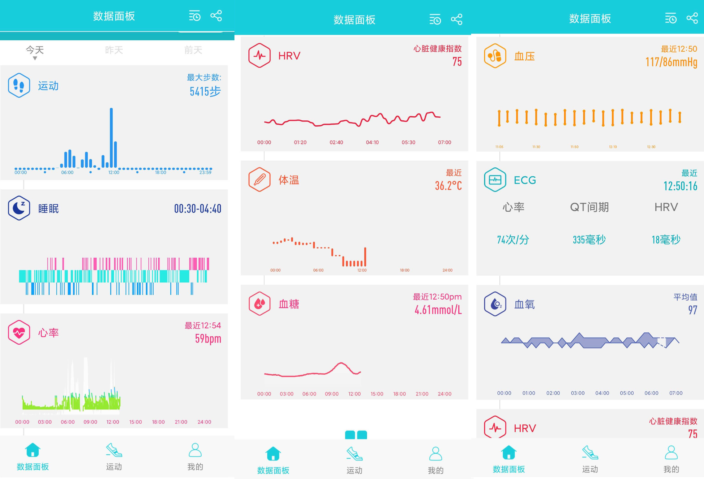 启明创投|随时监测身体各项数据，didoE55S Pro智能手表真不错