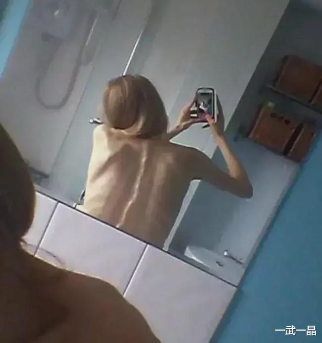 女孩 把50cm仙女管塞入体内,遭1.7亿人围观:这是自虐性行为上瘾?