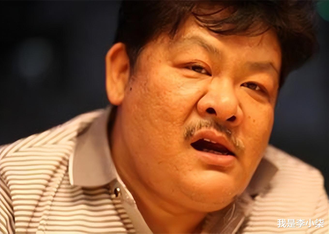 |58岁林雪罕见露面!脸上出现大片黑斑, 不少观众纷纷忧心他的健康