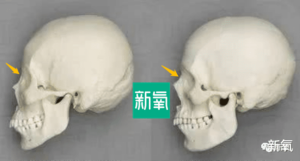 整形|李敏镐新剧里的女主被夸脱离清一色整形脸？