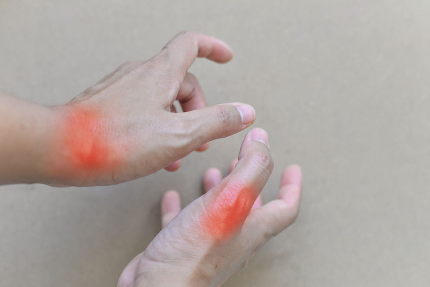 痛风|痛风发作，为减轻痛苦，这5类食物要少碰，或能避免病情反复