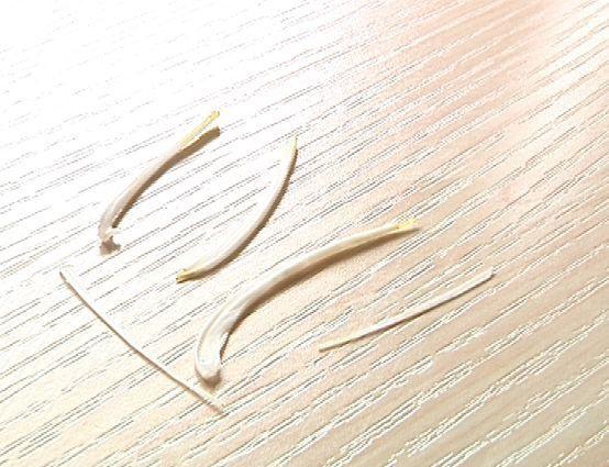 尿蛋白|鱼刺卡喉怎么办？正确的处理方法不是吞饭、喝醋，而是这两种