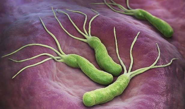 幽门螺杆菌|幽门螺杆菌太顽固?别急,常用这玩意泡水喝,肠胃想不健康都难