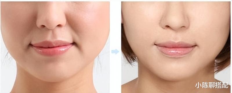 |为什么有的娃娃脸老了还显年轻，有的却越来越显老？主要看这3点