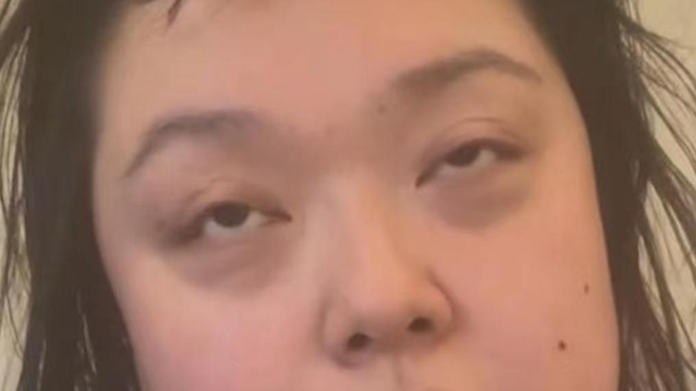 陈嘉佳|憔悴！TVB前搞笑女星晒病恹恹近况，曝三天没洗头没洗澡连狗都嫌臭