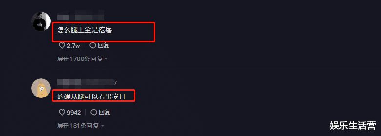 秦岚|42岁秦岚近况曝光,双腿坑洼滤镜都挡不住,网友:终究还是老了