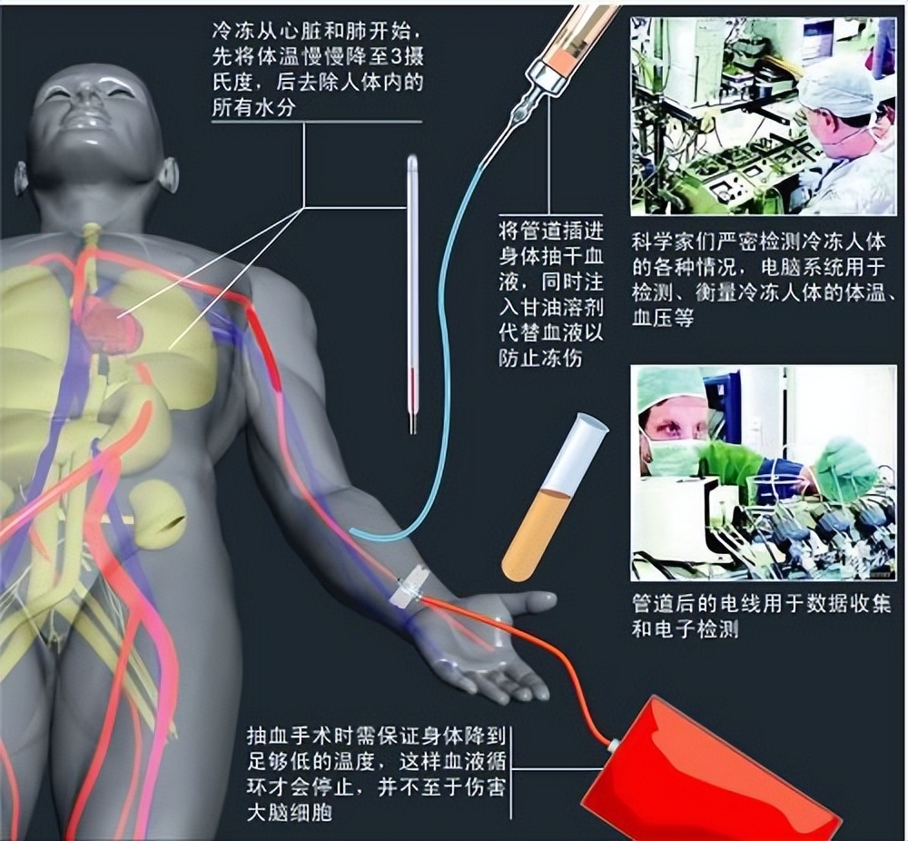 冷冻第一人詹姆斯·贝德福德,原本应在5年前醒来,现在怎么样了?