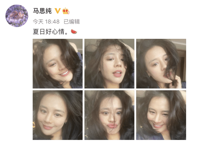 马思纯 马思纯和妈妈一同外出，扎丸子头发际线上移，被网友质疑产后脱发