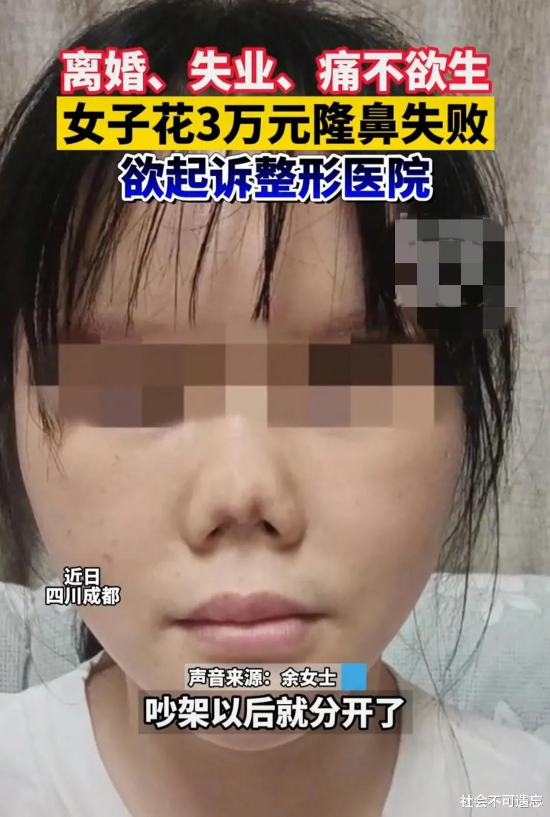 整容 花3万整容，结果整成了“猪鼻子”，女子：事业和家庭都没了