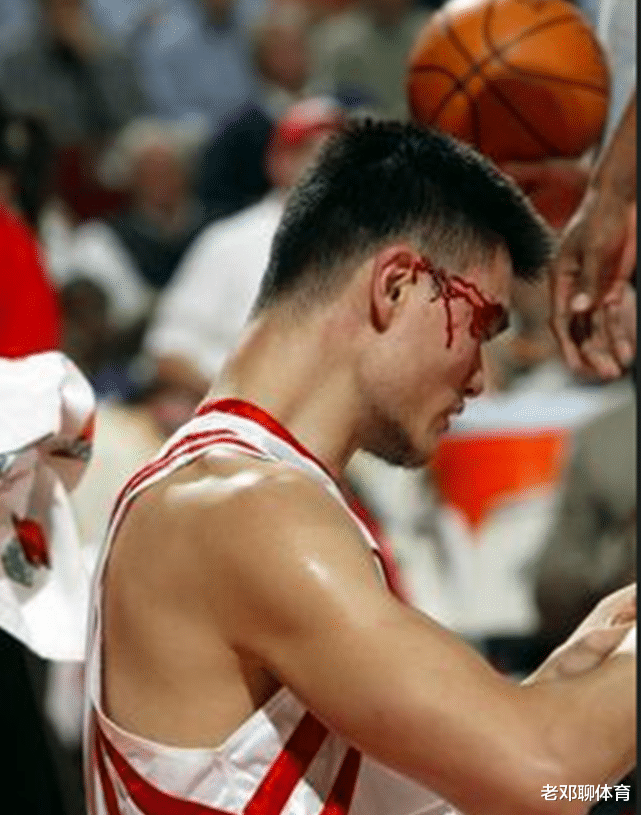 姚明|为何说姚明在NBA6亿工资是透支身体赚的，这5张照片给你答案