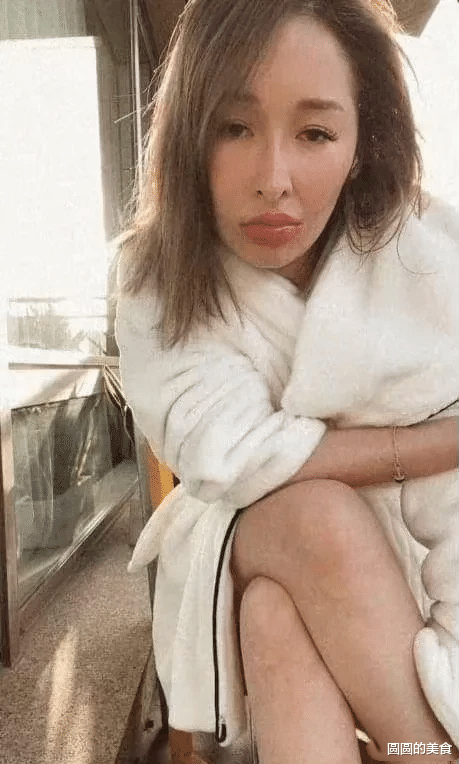 萧亚轩|萧亚轩首度公开被狗咬后素颜照，即使做了修复手术，脸部明显凹凸不平