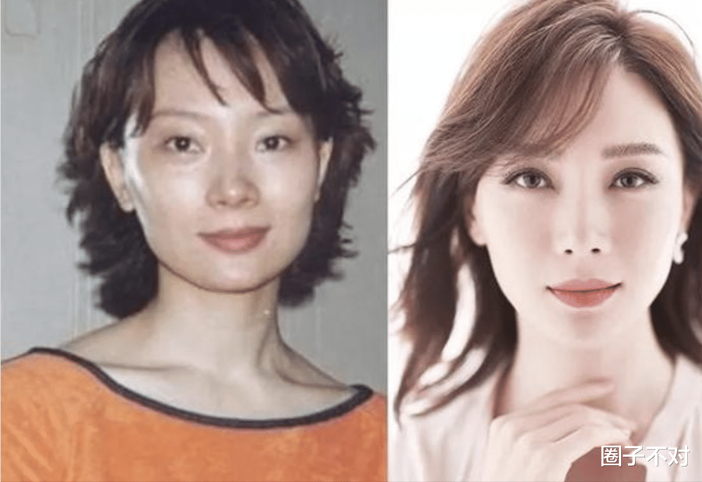 整容|脸没恢复就别接戏了，顶着整容脸演啥都奇怪，这些女星好意思吗？