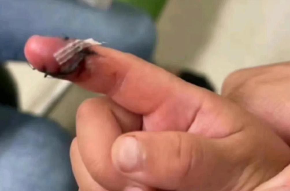 张恒|张恒指控爽子虐娃,并晒出孩子受伤照片